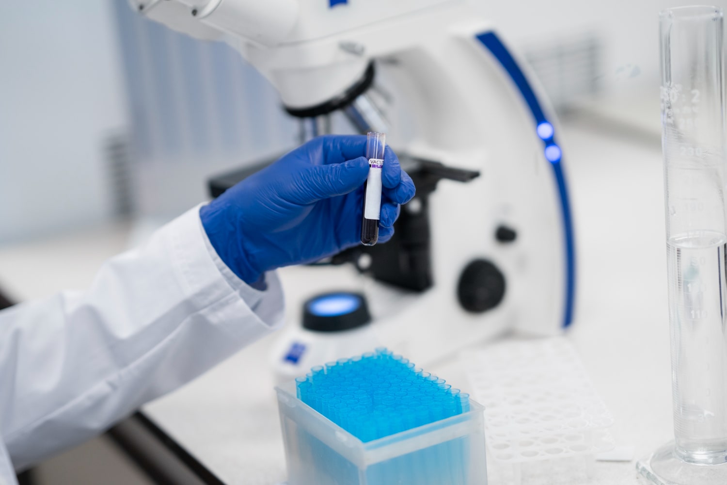 Laboratorija - ZU Specijalna bolnica MaxMedic